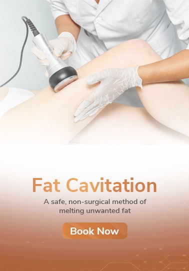 Fat Cavitation - Mobile