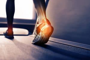Joint pain and Sports injury from running