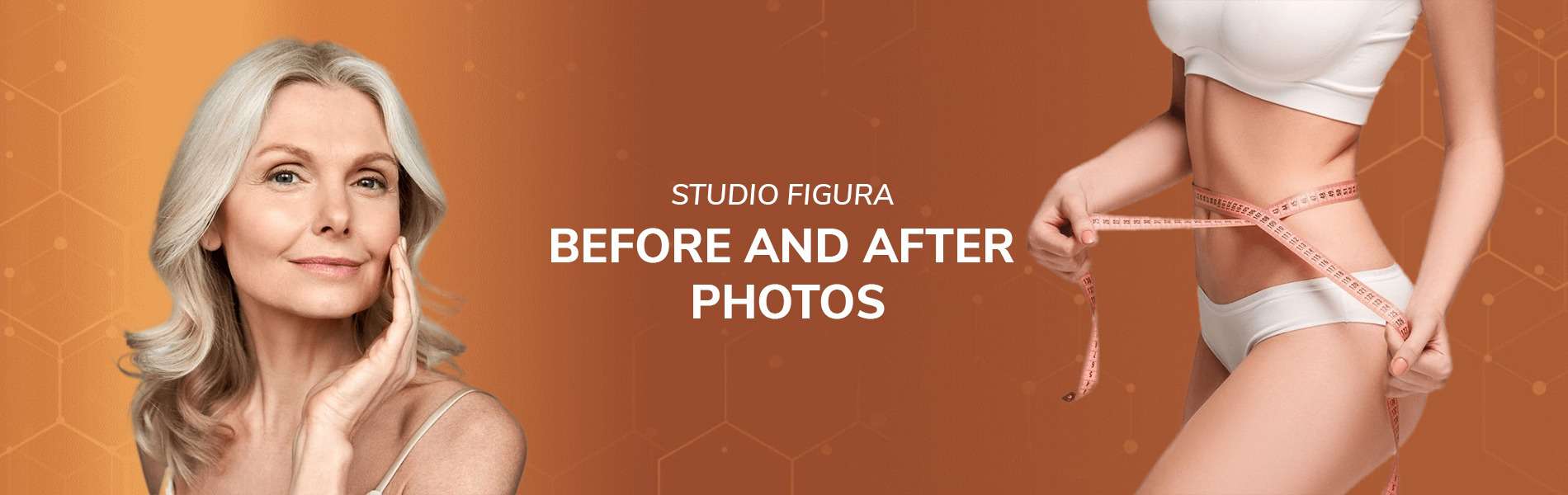 before and after - Studio Figura au - Book Now - 3