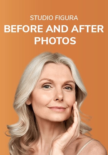 before and after - Studio Figura au - Book Now - Mobile - 2