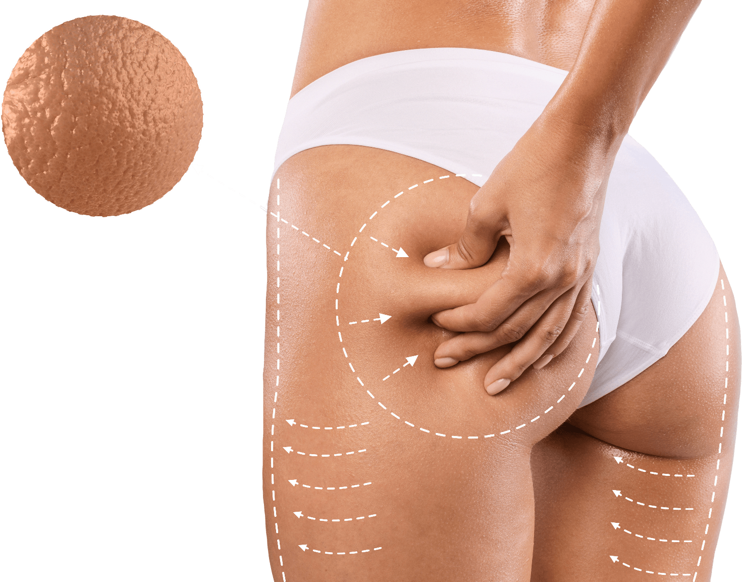 https://www.studiofigura.com.au/wp-content/uploads/2023/02/Body-Cellulite-Reduction-Treatment-White-2.png