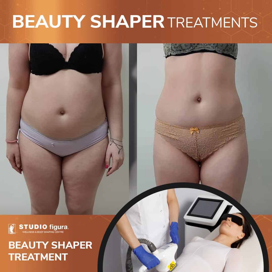 Beauty-Shaper.jpg