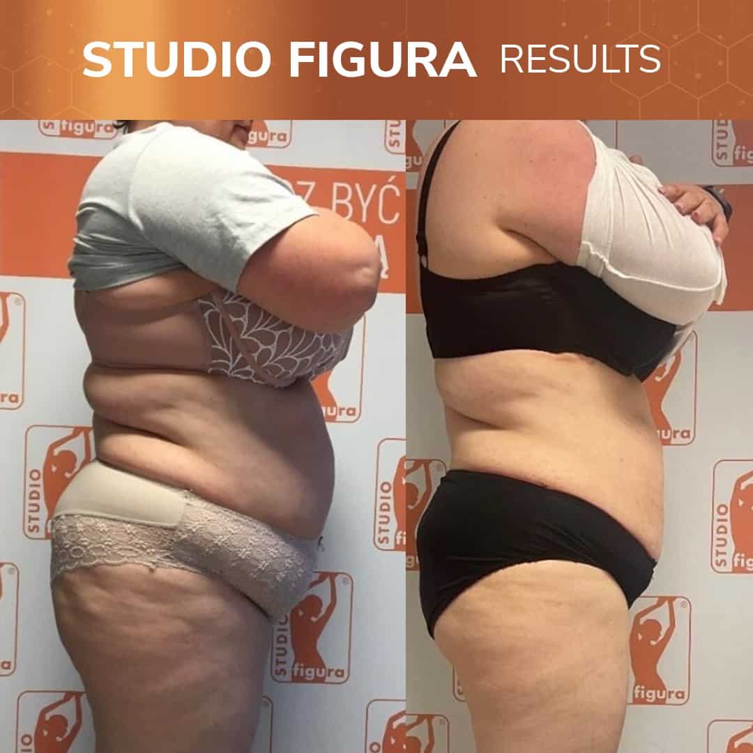 Before-and-After-Studio-Figura-AU-8-a.jpg