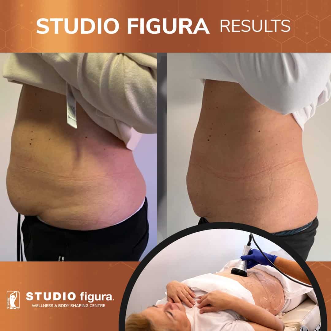Studio-Figura-Results-01.jpg