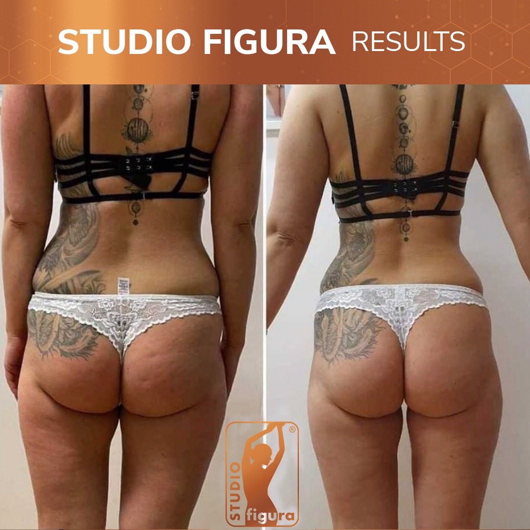 Studio-Figura-Results-02.jpg