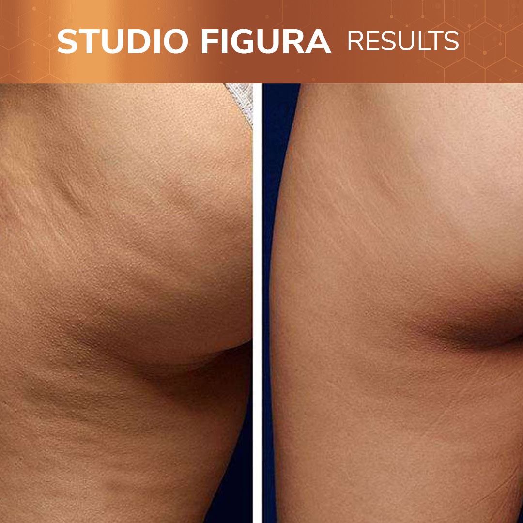 Studio-Figura-Results-04.jpg