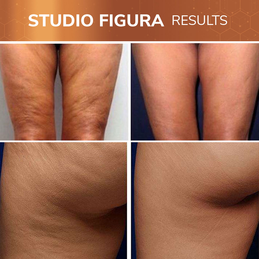 Studio-Figura-Results-05.jpg