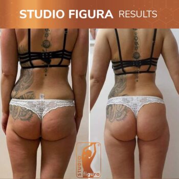 Studio Figura Results 02