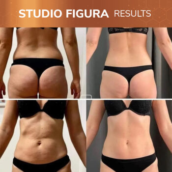 Studio Figura Results 03